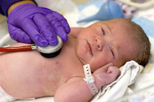 Критерии оценки тяжести состояния у новорожденных детей