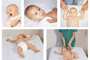 Критерии оценки тяжести состояния у новорожденных детей